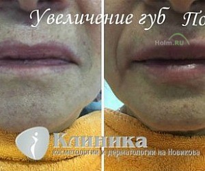 Клиника косметологии и дерматологии на Новикова