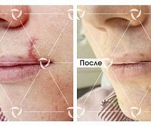 Клиника лазерной косметологии ЛИНЛАЙН на Садовой-Спасской улице