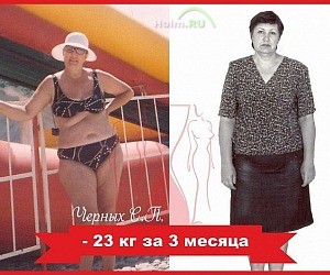 Клиника похудения Елены Морозовой «Славянская клиника»